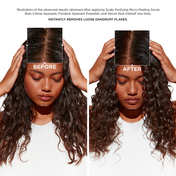Symbiose Soothing Night Serum for Sensitive Scalps Prone to Dandruff